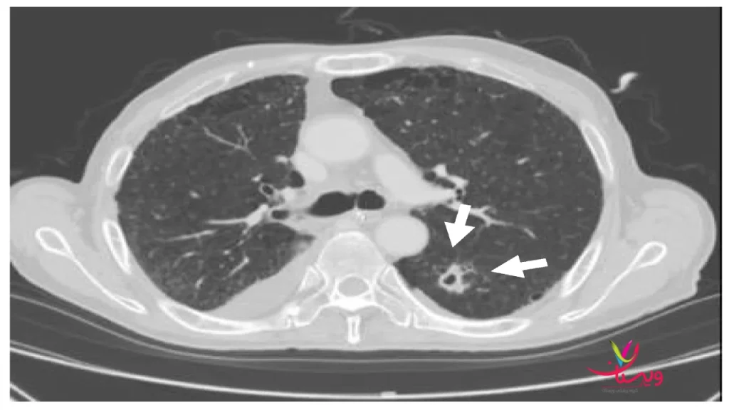 مشکلات تیروئیدی چه چیزهایی را اسکن نشان نمیدهد؟