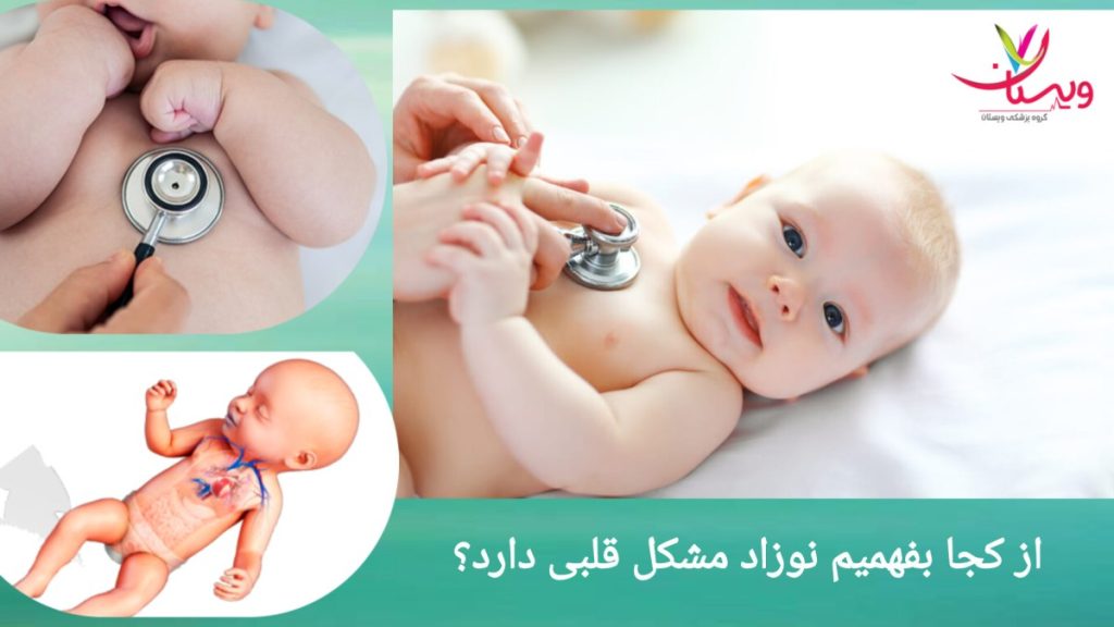 معاینه و تست های قلبی نوزاد معاینه قلب نوزاد توسط پزشک