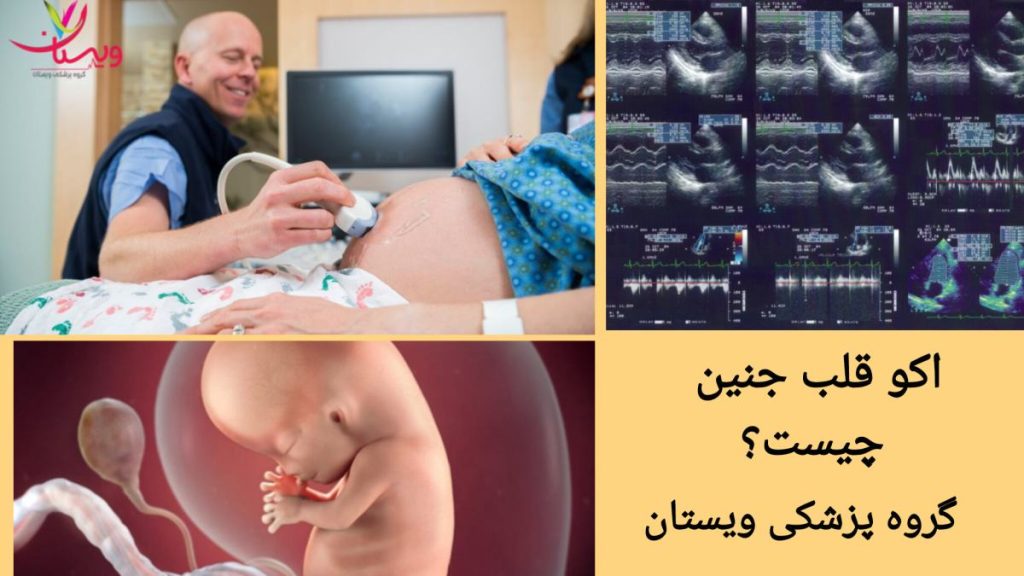 آشنایی با کاربردهای اکو قلب جنین آشنایی با روش تصویربرداری قلب جنین