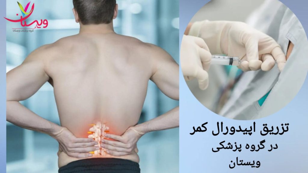 تزریق در ناحیه کمر بیمار برای کاهش درد