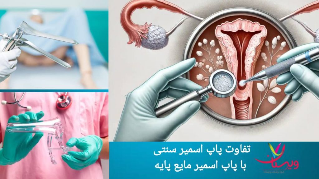 مقایسه روش های مختلف غربالگری مقایسه آزمایش سنتی و مایع پایه پاپ اسمیر