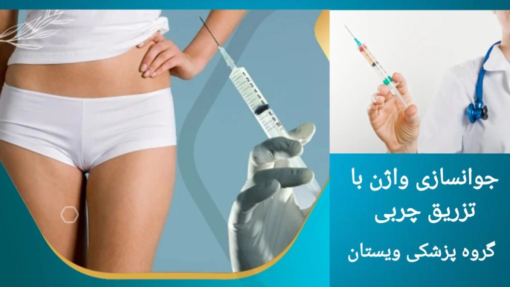 تزریق چربی برای جوان سازی واژن معرفی روش جوان سازی واژن با تزریق چربی
