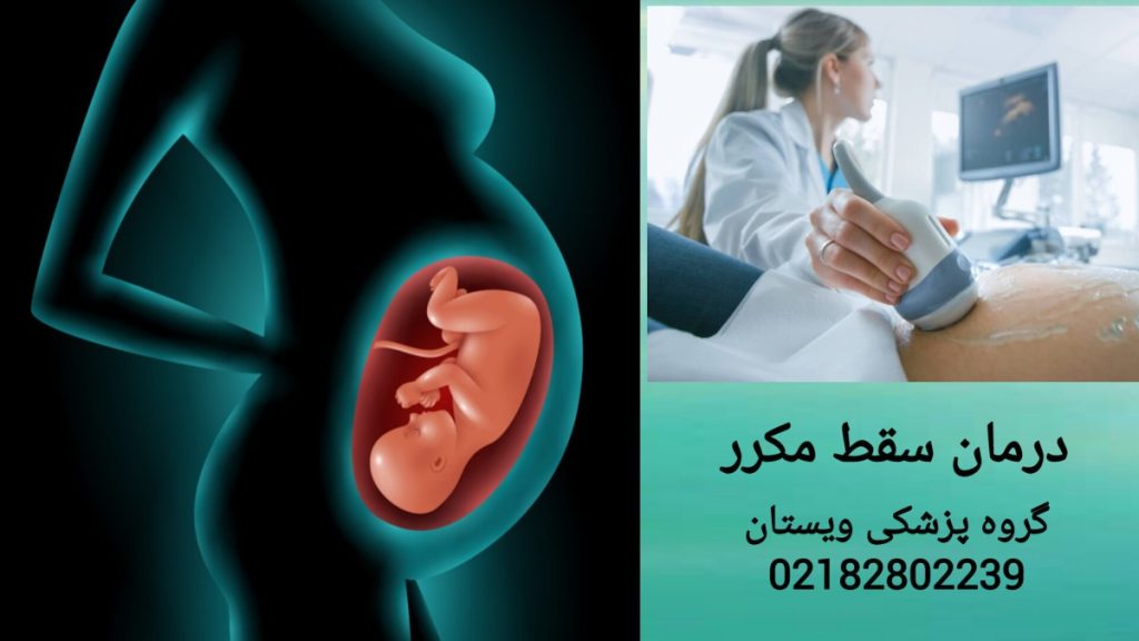 مراقبت های پزشکی برای درمان سقط مکرر