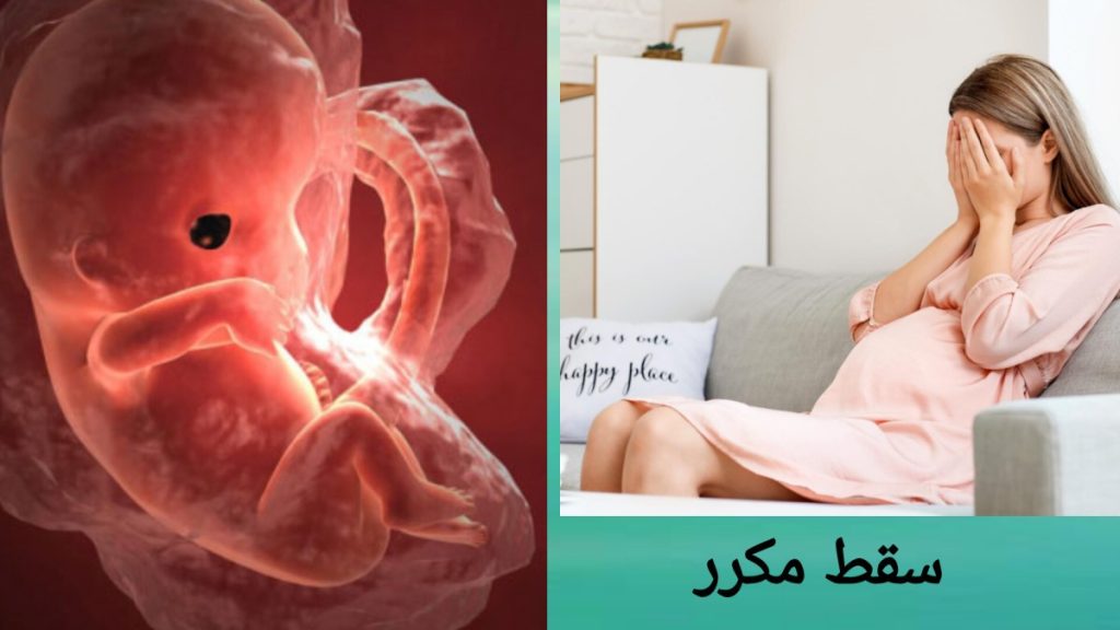 تعریف علمی سقط مکرر مفهوم و درمان سقط مکرر