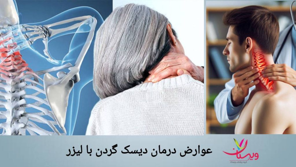 عوارض درمان دیسک گردن با لیزر مشکلات احتمالی پس از درمان دیسک گردن با لیزر