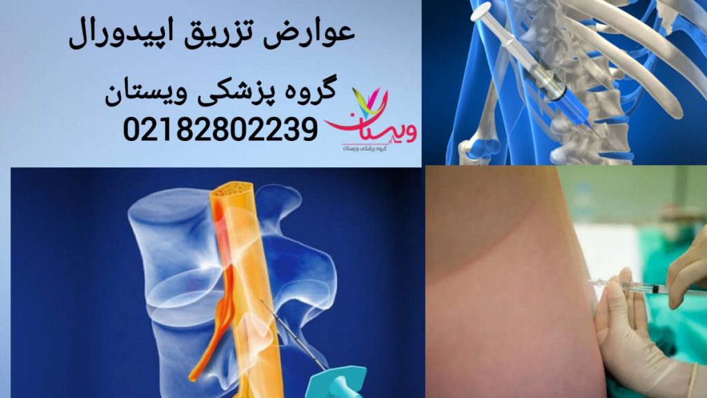 بررسی عوارض احتمالی تزریق دارو