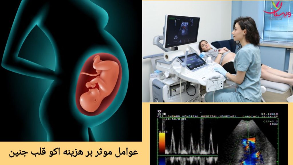 بررسی تعرفه و قیمت اکوی قلب عواملی که بر هزینه اکوی قلب جنین تاثیر دارد
