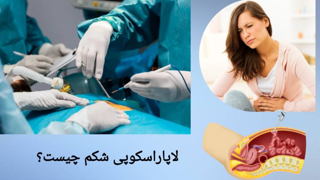 بررسی اندام های داخلی با لاپاراسکوپی شکمی نمونه جراحی لاپاراسکوپی شکمی