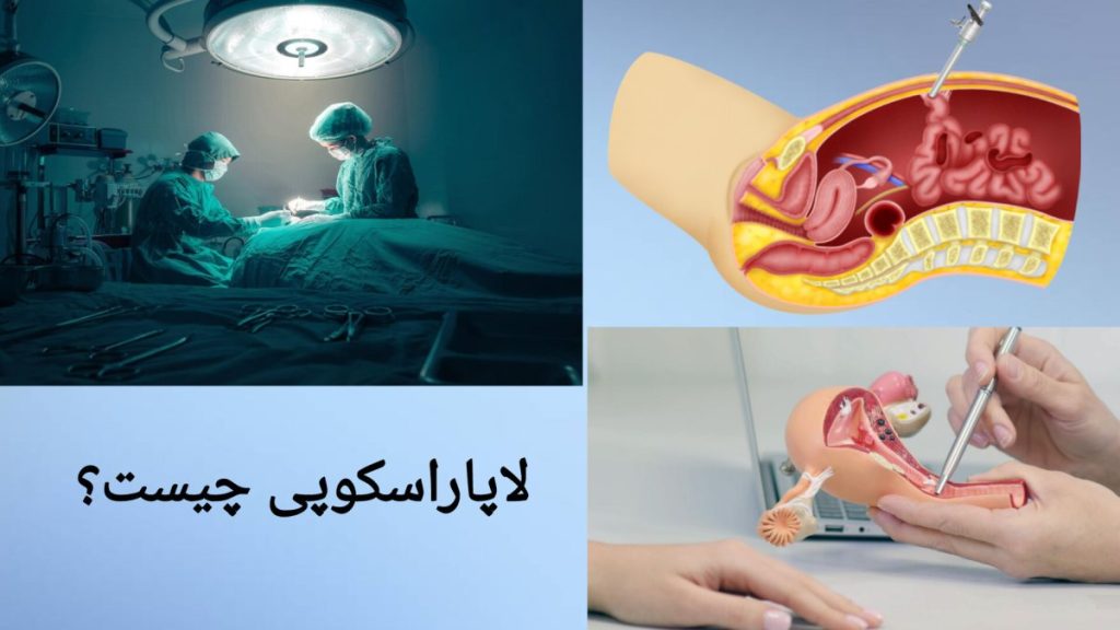 معرفی روش انجام لاپاراسکوپی معرفی ابزار و تجهیزات برای جراحی لاپاراسکوپی زنان