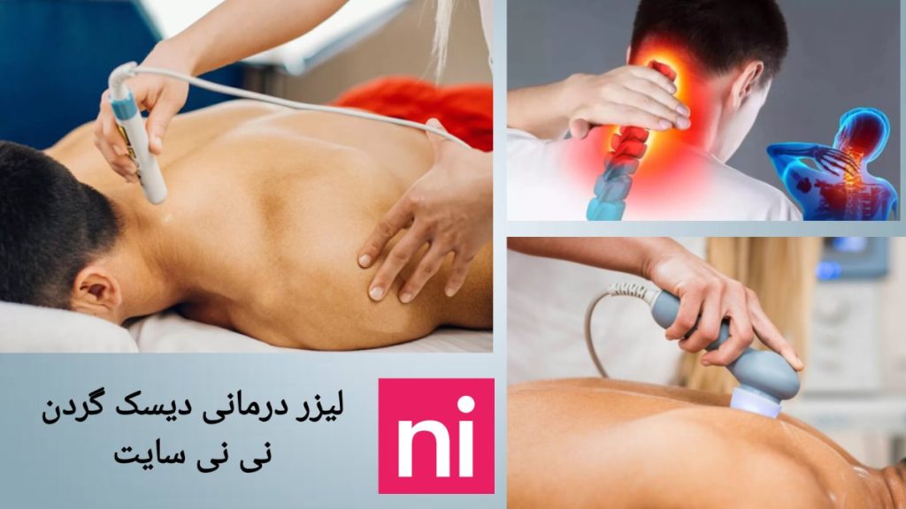 نظرات کاربران نی نی سایت نظرات کاربران نی نی سایت از درمان دیسک گردن با لیزر