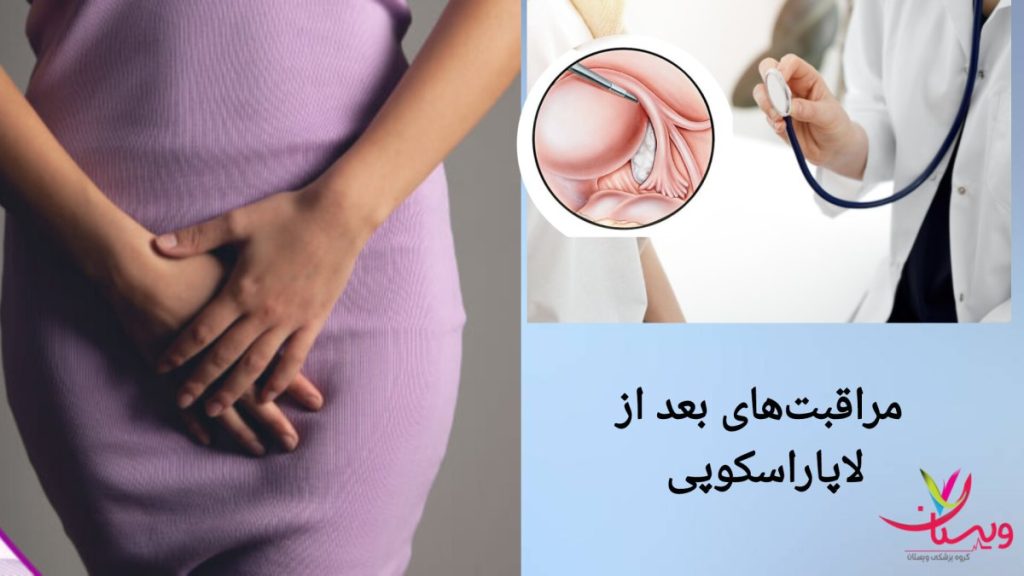 مراقبت های لازم بعد از جراحی لاپاراسکوپی زنان