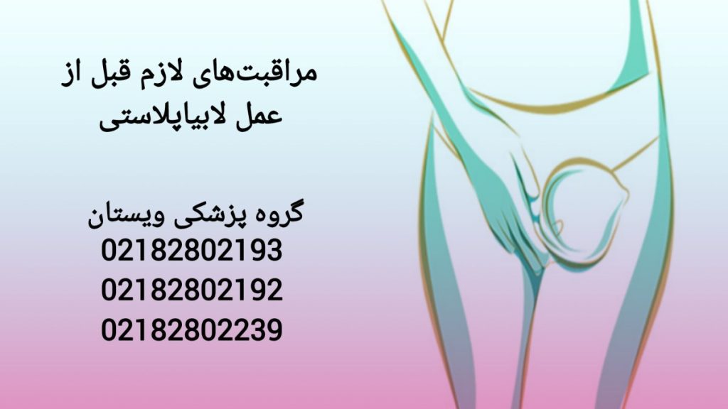اقدامات لازم قبل از جراحی لابیا