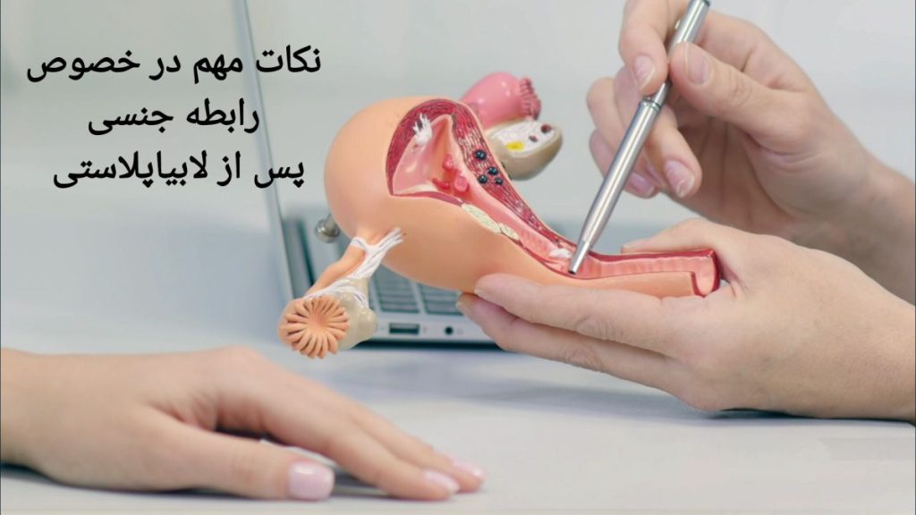 رابطه جنسی بعد از جراحی لابیاپلاستی زمان شروع رابطه پس از جراحی لابیاپلاستی