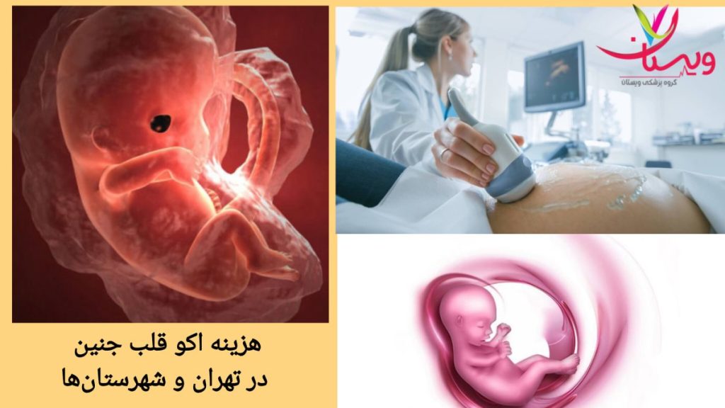 مقایسه قیمت اکو قلب جنین در تهران و شهرستان ها