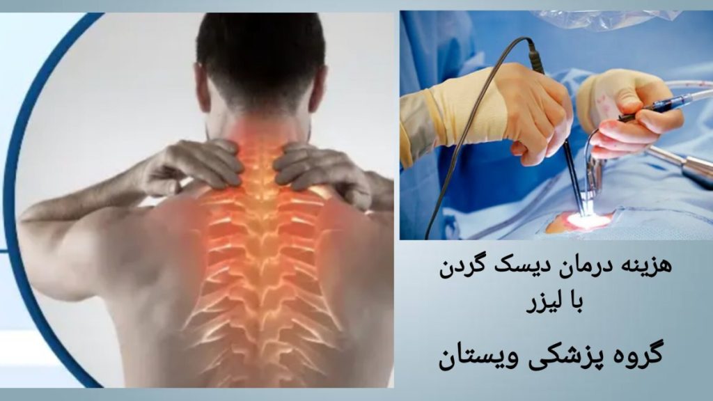 قیمت لیزر درمانی گردن قیمت لیزر درمانی دیسک گردن
