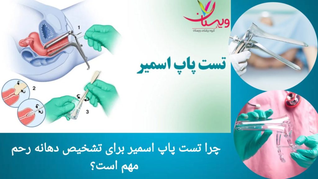 اهمیت تست پاپ اسمیر در شناسایی سرطان دهانه رحم