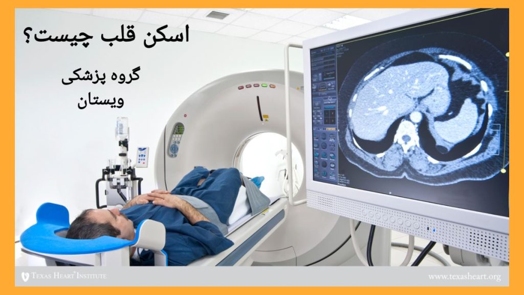 توضیح علمی اسکن قلب اسکن قلب چگونه است