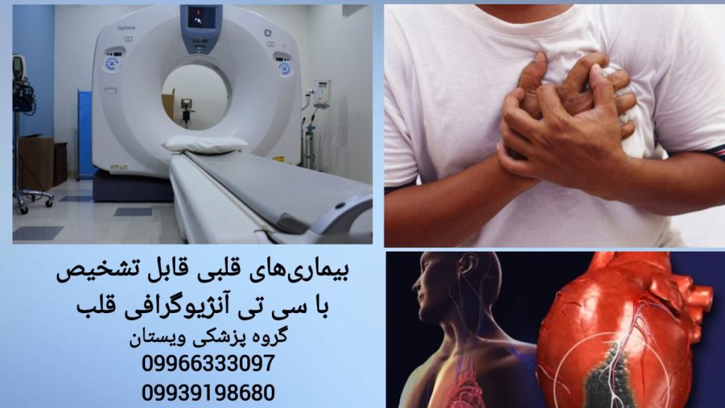 نقش سی تی آنژیو در تشخیص بیماری های قلبی