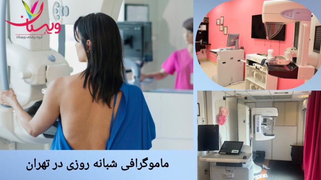 مراکز ماموگرافی 24 ساعته معرفی مراکز ماموگرافی شبانه روزی در تهران