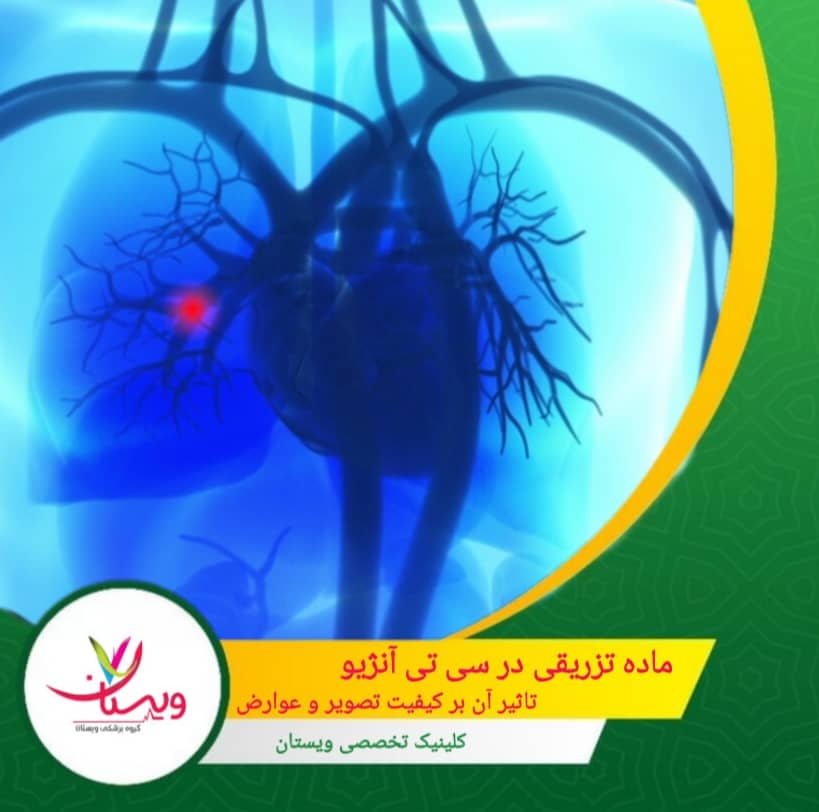 ماده تزریقی در سیتی آنژیو؛ تأثیر آن بر کیفیت تصویر و عوارض