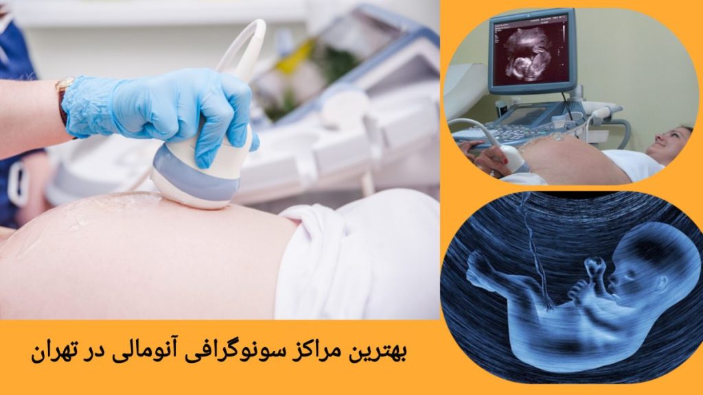 مراکز تخصصی سونوگرافی آنومالی معرفی مراکز معتبر سونوگرافی آنومالی