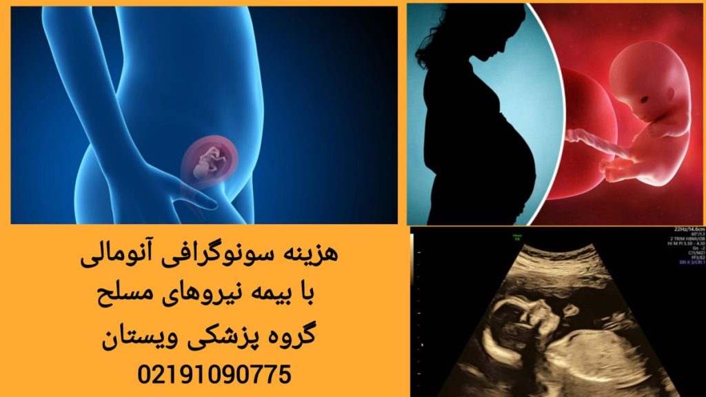 هزینه سونوگرافی آنومالی با بیمه نیروهای مسلح تعرفه سونوگرافی آنومالی با بیمه نیروهای مسلح