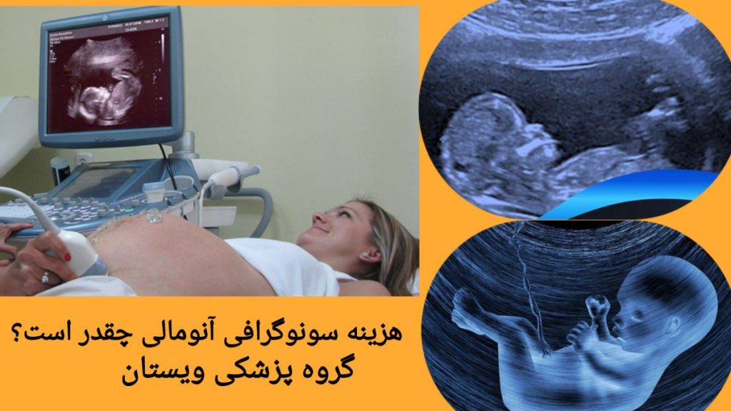 تعرفه سونوگرافی آنومالی با بیمه مقایسه هزینه سونوگرافی آنومالی با بیمه و آزاد