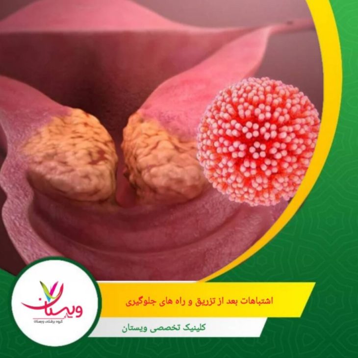 قطع خودسرانه دارو، عدم رعایت بهداشت محل تزریق یا استفاده از محصولات غیرمجاز، ریسک بروز عفونت یا التهاب را افزایش میدهد. اشتباهات رایج بعد از تزریق و راههای جلوگیری