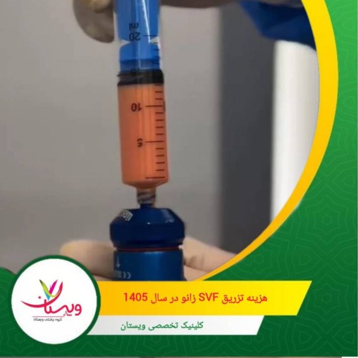 پزشکان باتجربه هزینه بالاتری دارند، اما دقت و نتایج تضمینیتر است. هزینه تزریق SVF زانو در سال ۱۴۰۵