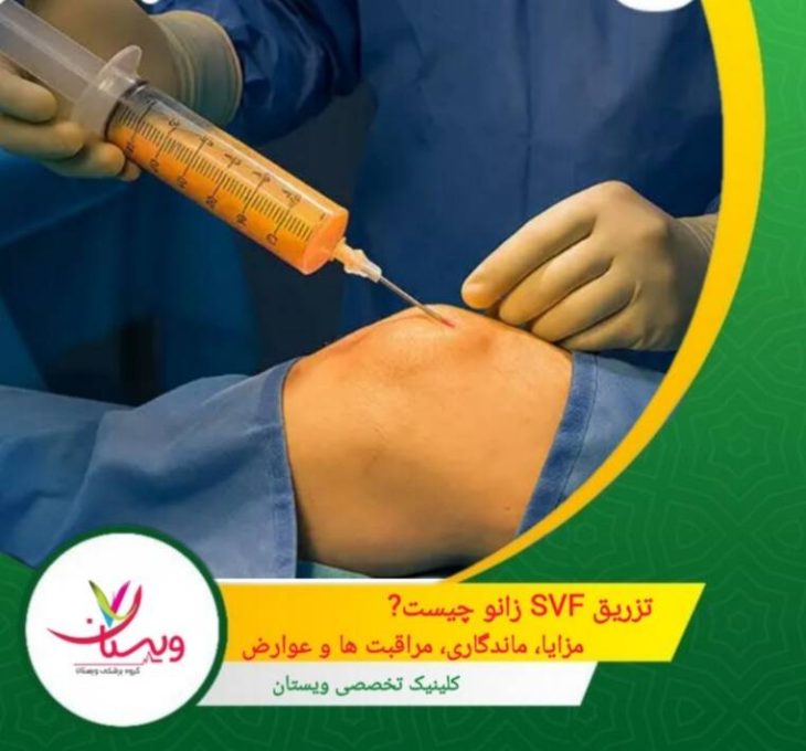 تزریق SVF زانو چیست؟ مزایا، ماندگاری، مراقبت ها و عوارض
