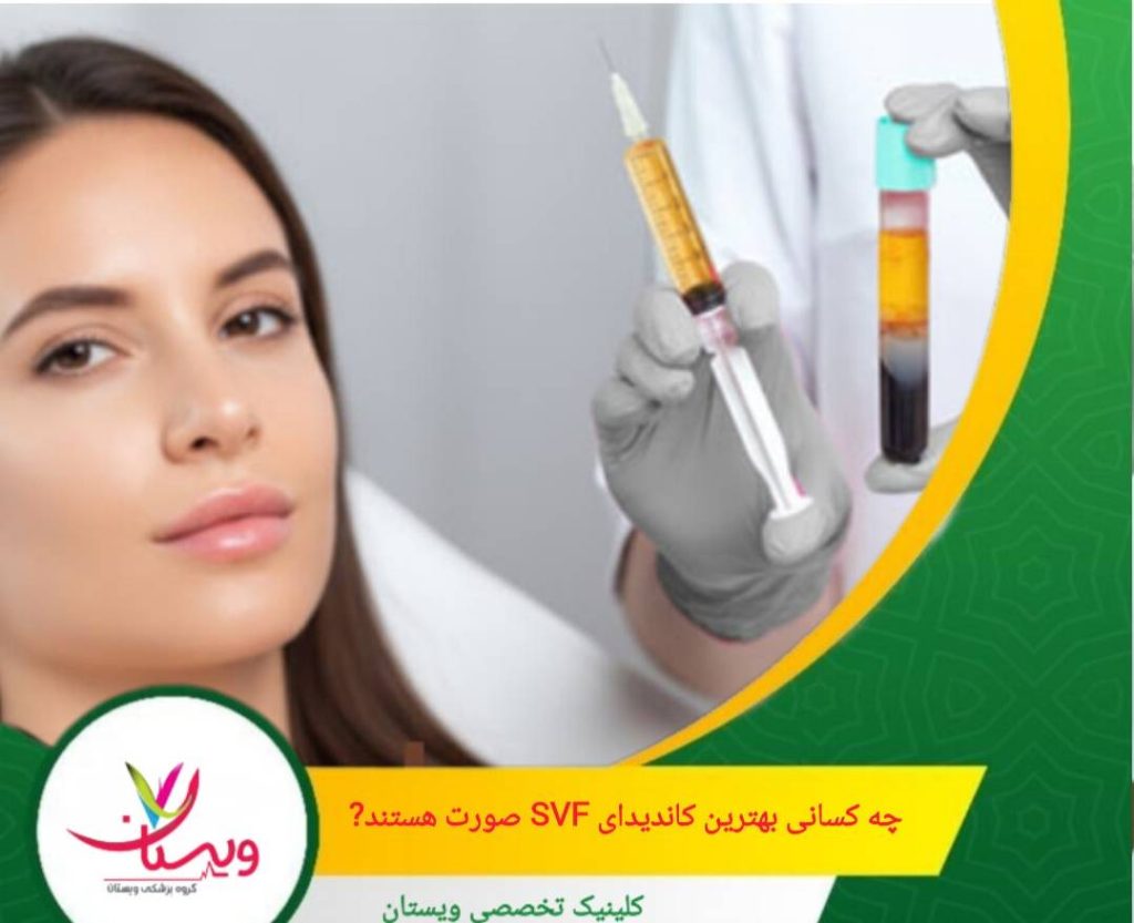 کسانی که نمیخواهند هر ۶ ماه فیلر تمدید کنند بهترین کاندیدای SVF صورت هستند. چه کسانی بهترین کاندیدای SVF صورت هستند؟