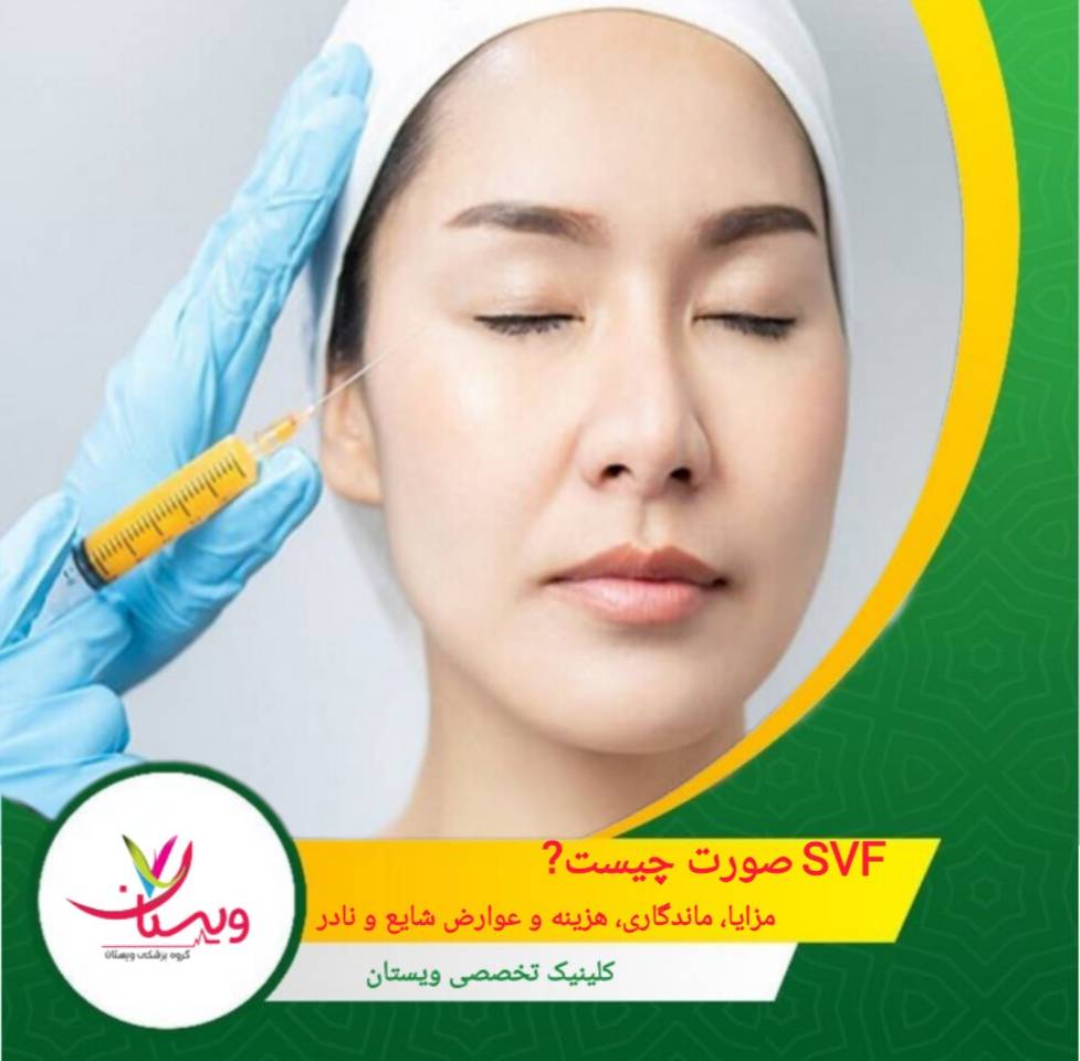 SVF صورت چیست؟ ماندگاری، عوارض، هزینه و بهترین مراکز