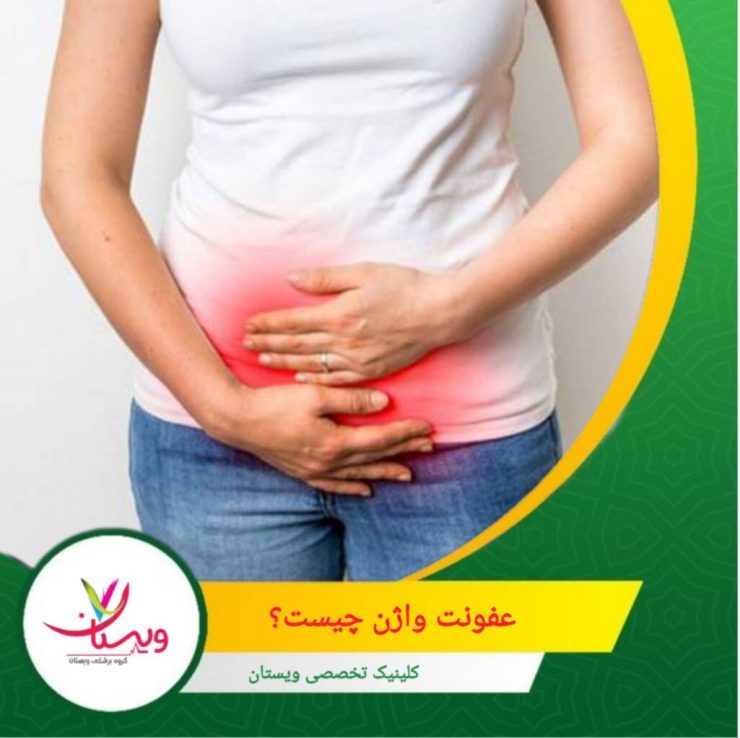عفونت واژن یا واژینیت، به التهاب یا عفونت واژن گفته میشود که میتواند با علائم مختلفی مانند خارش، سوزش، ترشحات غیرطبیعی، بوی ناخوشایند و درد همراه باشد. عفونت واژن چیست؟