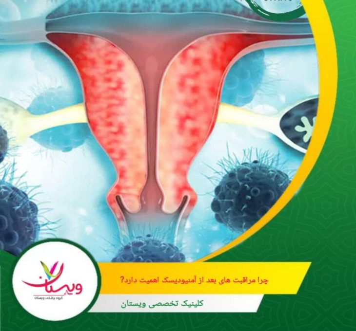 اگر مراقبتهای پس از تزریق به درستی رعایت شود، بسیاری از مشکلات کوتاهمدت مانند درد خفیف، لکهبینی، التهاب موضعی و حتی عفونتهای نادر قابل پیشگیری هستند. چرا مراقبتهای بعد از آمنیودیسک اهمیت دارد؟