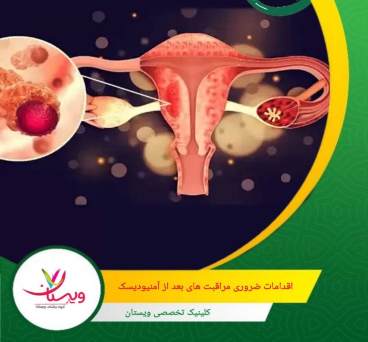مصرف مواد غذایی سرشار از پروتئین، ویتامینهای A، C، E و زینک، و نوشیدن مقدار کافی آب، فرآیند بهبود را تسریع میکند. اقدامات ضروری مراقبتهای بعد از آمنیودیسک
