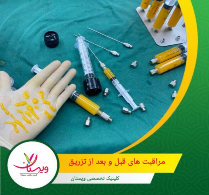رعایت محدودیتهای دارویی و غذایی قبل تزریق توصیه می شود. مراقبتها و تاثیر آن بر قیمت نهایی