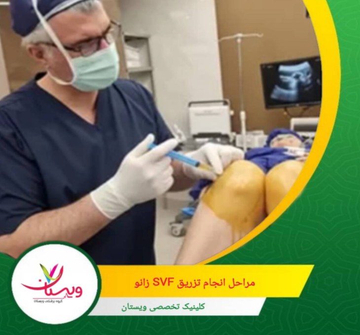 بسته به شدت آسیب، جلسات تکمیلی بعد از ۶–۱۲ ماه ممکن است نیاز باشد. مراحل انجام تزریق SVF زانو