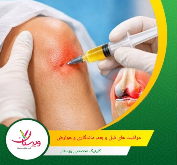 مهمترین عامل پیشگیری از عوارض، انتخاب مرکز درمانی مجهز با تجهیزات استاندارد و تیم درمانی باتجربه است که فرایند استخراج و تزریق سلولها را با دقت بالا انجام دهد. مراقبتهای قبل و بعد، ماندگاری و عوارض