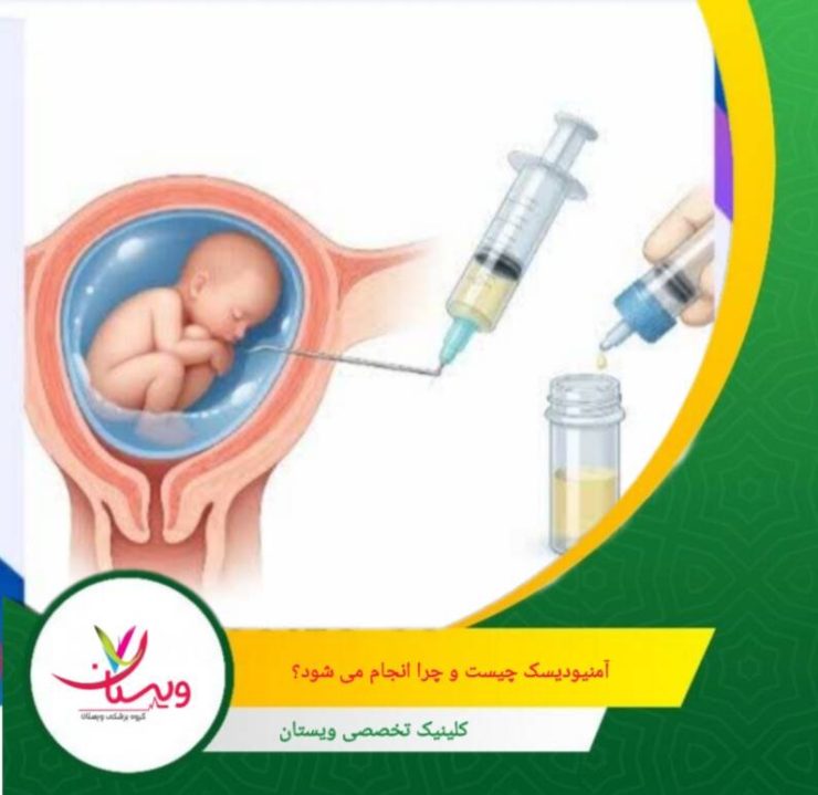 نکته مهم این است که آمنیودیسک درمان خط اول همه بیماران نیست و معمولاً در موارد انتخابی و با ارزیابی دقیق تجویز میشود. آمنیودیسک چیست و چرا انجام میشود؟