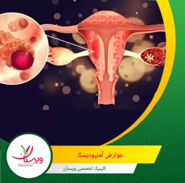 در مواردی که تزریق در ناحیه رحم یا دهانه رحم انجام میشود، لکهبینی کوتاهمدت ممکن است دیده شود. عوارض آمنیودیسک چیست؟ بررسی کامل عوارض احتمالی