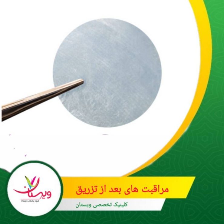یکی از عوامل مهم در پیشگیری از مشکلات احتمالی، رعایت دقیق توصیههای پس از درمان است. مراقبتهای بعد از تزریق برای کاهش عوارض آمنیودیسک