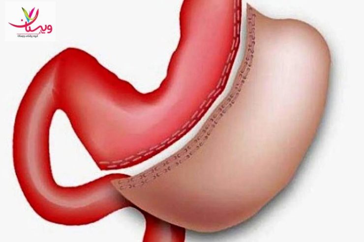 عمل اسلیو در بیمارستان دولتی؛ هزینه، کیفیت و ایمنی