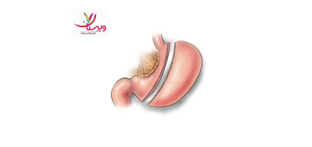 چالشهای جراحی در بخش دولتی؛ آنچه باید بدانید
