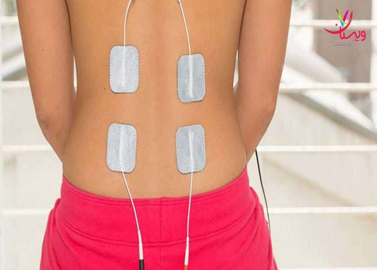 تست EMG فعالیت الکتریکی عضله را در پاسخ به تحریک عصبی اندازهگیری میکند. تست EMG یا نوار عصب و عضله چیست و چگونه کار میکند؟