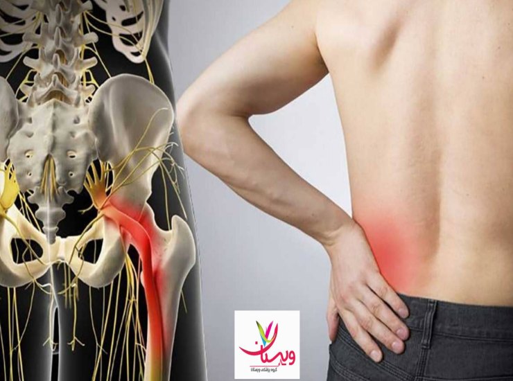 پزشک الکترودهای کوچکی را روی نقاط مختلف پا میچسباند. شوکهای الکتریکی بسیار خفیفی (شبیه به الکتریسیته ساکن لباس) وارد میشود تا سرعت عصب سنجیده شود. مراحل انجام تست نوار عصب و عضله