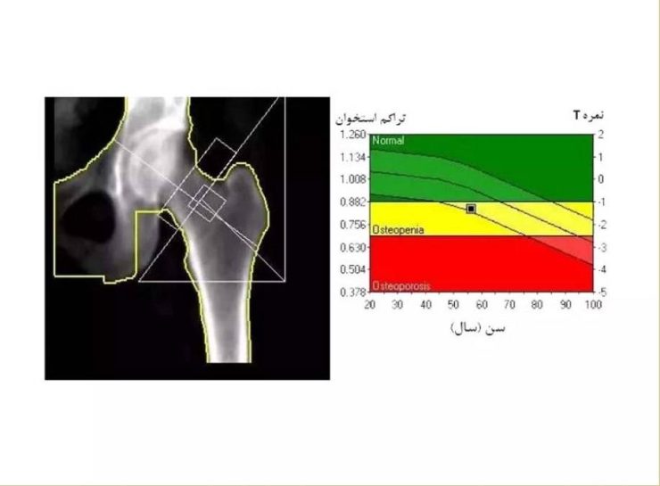 رعایت پروتکلهای بهداشتی در بالاترین سطح، آرامش خاطر را برای مراجعین بهویژه سالمندان فراهم میکند. چرا مرکز سنجش تراکم استخوان یاس ستارخان تهران را انتخاب کنیم؟