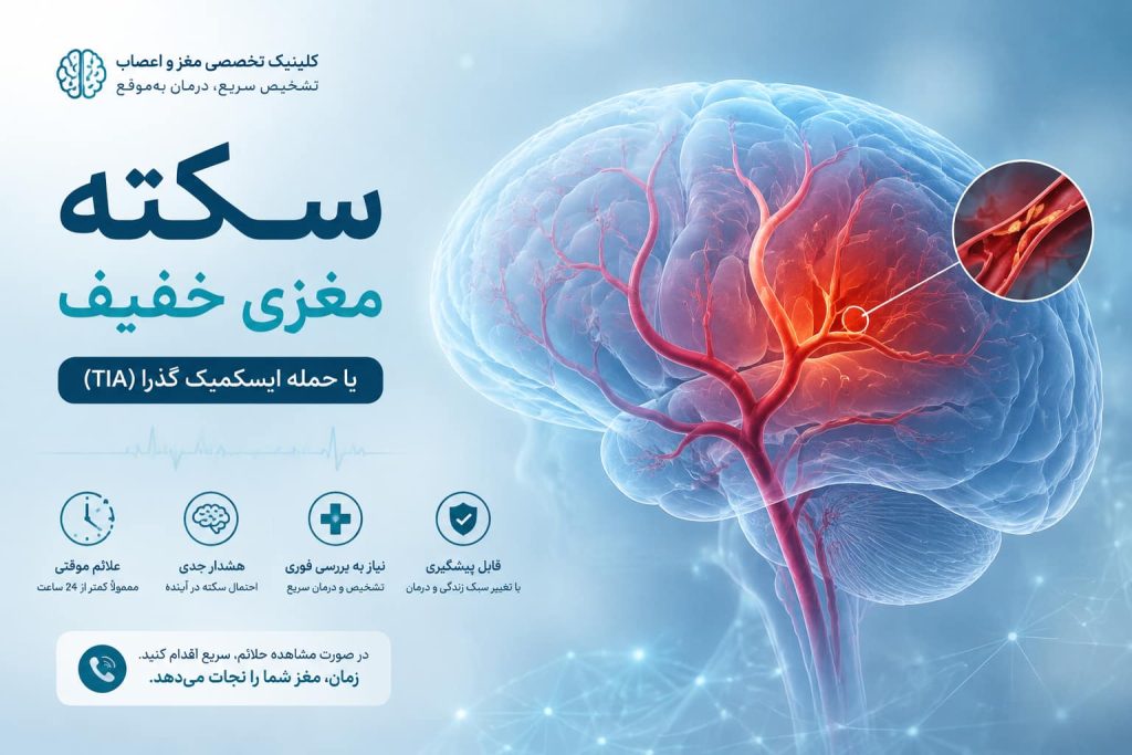 سکته مغزی خفیف